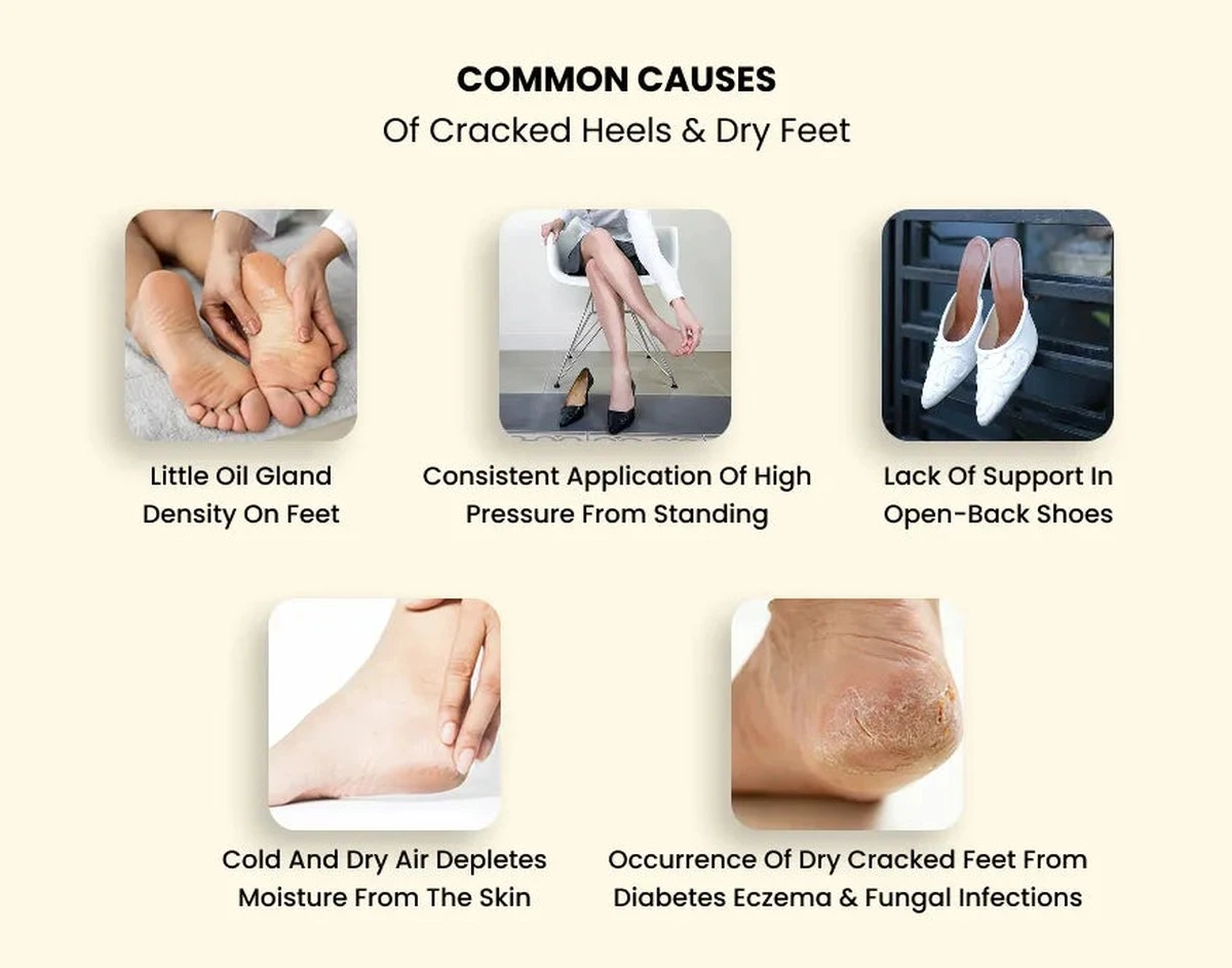 Olej na zpuchřelé paty? Trik kadeřnic, který nestojí víc než džem - image 2