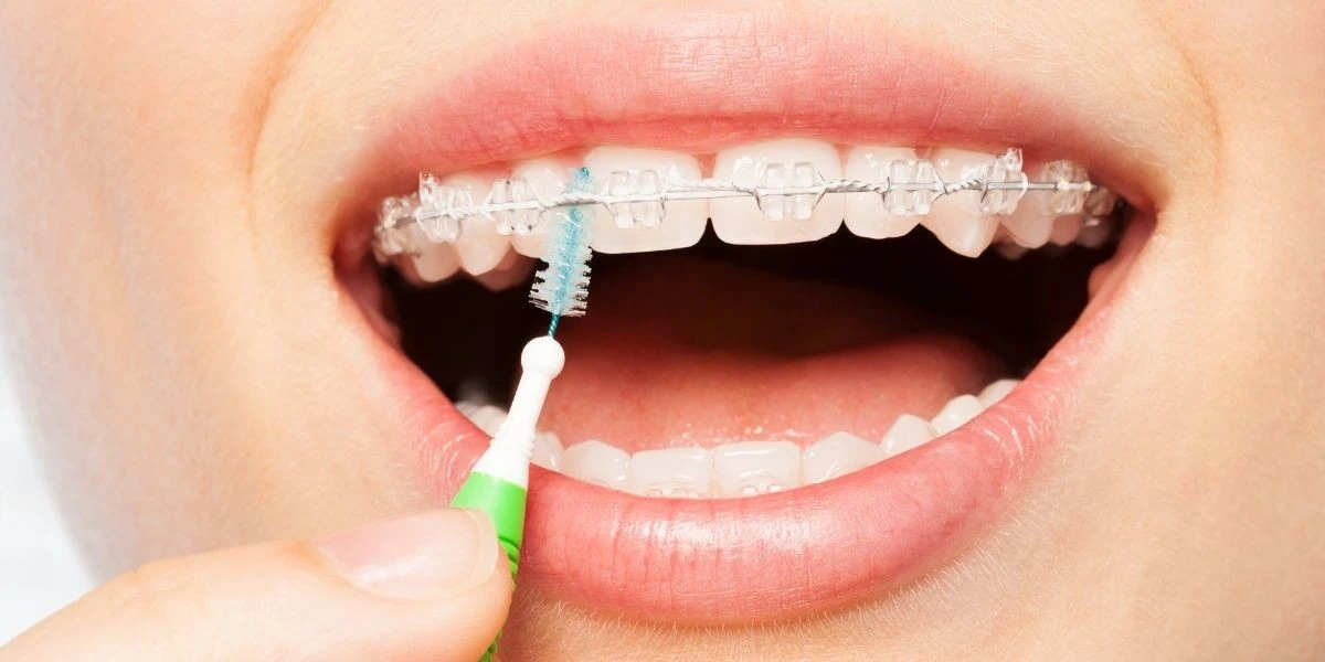 Kartáček na zuby pro těžko dostupné kouty – průmyslový trik